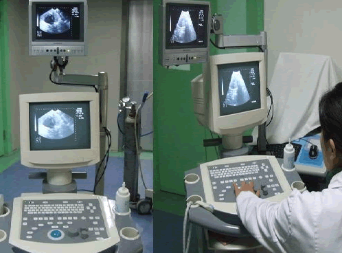 超导可视无痛人流设备