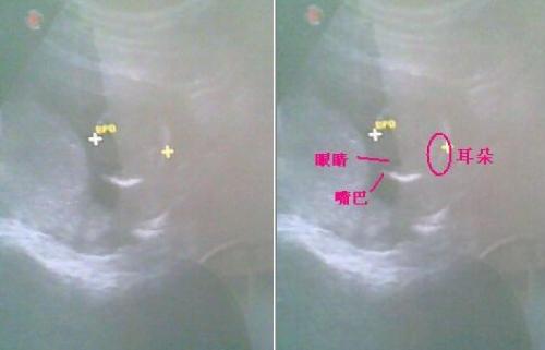 怀孕三个月胎儿