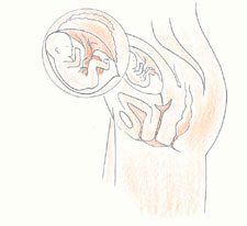 怀孕4个月胎儿图