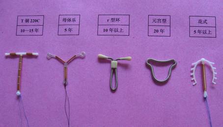 节育环的种类图片