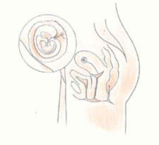 怀孕一个月的症状