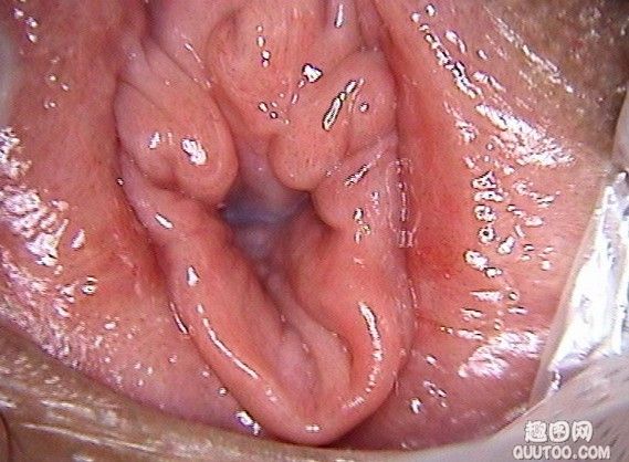 女性阴道口高清图片