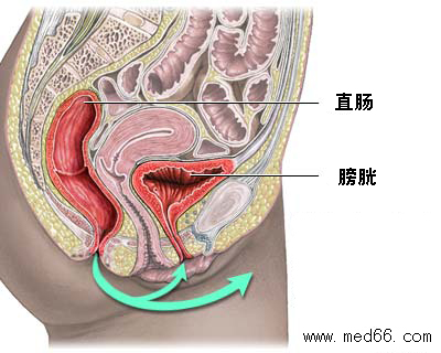 女性盆部科谱图