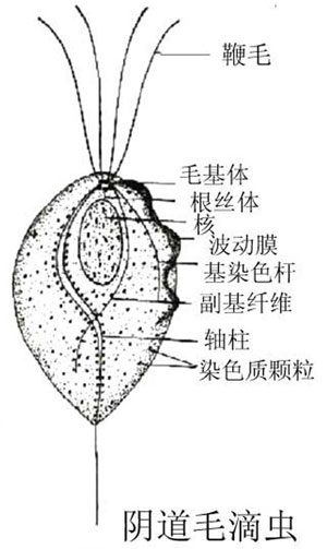 滴虫性阴道炎图片