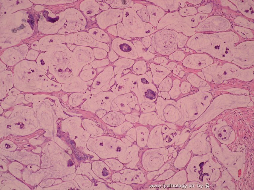 女性盆腔炎的症状图片