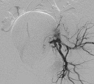 女性盆腔血管实物图