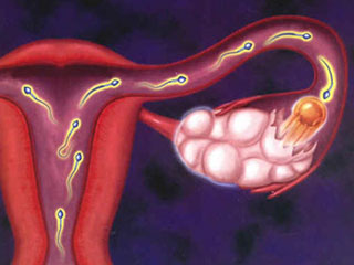 子宫内膜厚度多少正常
