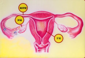 女性输卵管不通图片