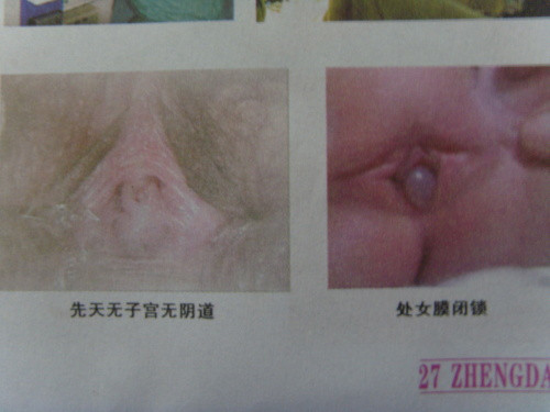  石女的特征图片