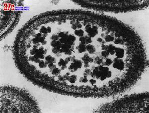 非淋病的早期症状图片 