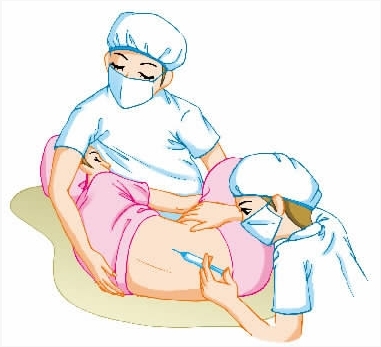 无痛分娩顺产图片